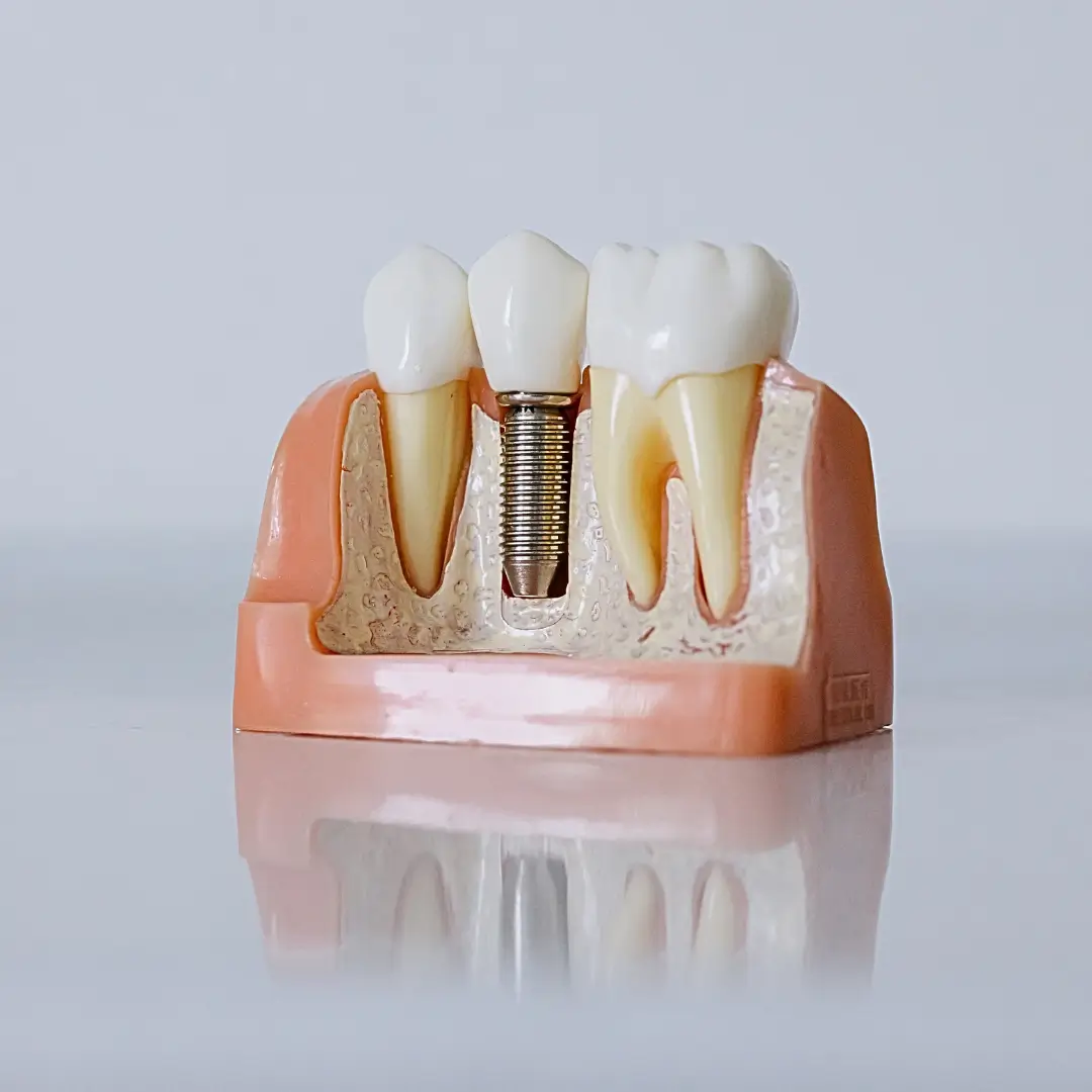 Venha para a Oral Brind